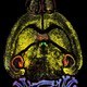 Inhibitory Neurotransmitter Receptors in Mouse Brain