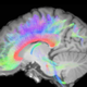 Connections of the Human Brain.