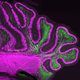 Axons in Mouse cerebellum.