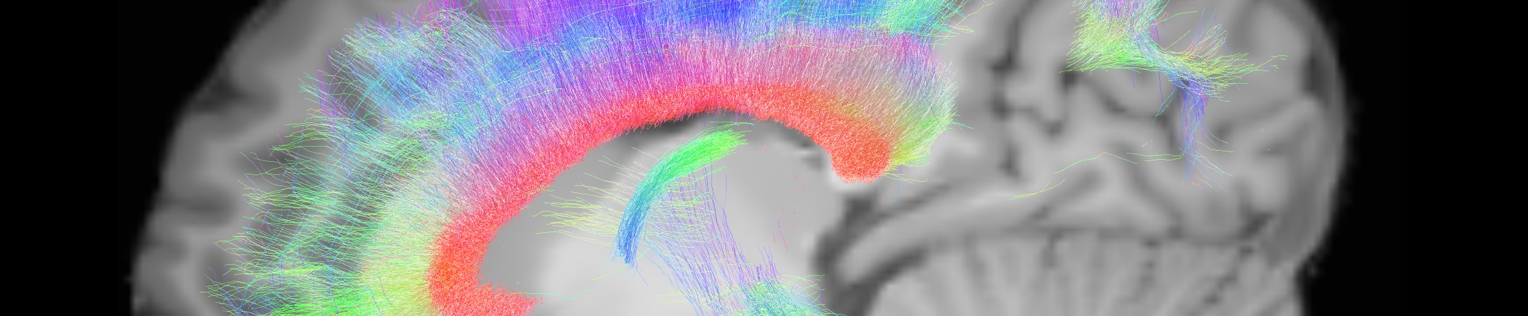 cropped_newsletter_PAPASbrain4